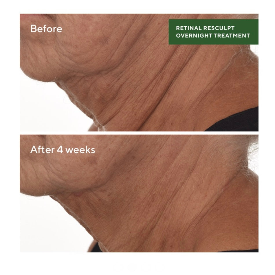 MURAD RETINAL RESCULPT OVERNIGHT TREATMENT