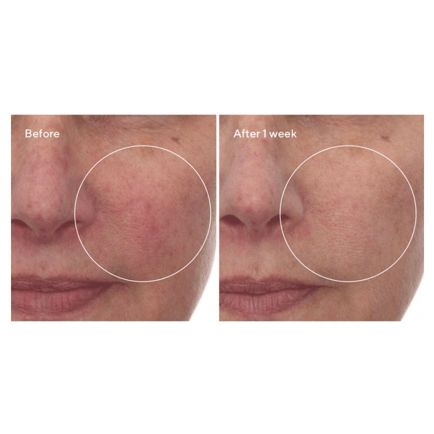 MURAD CELLULAR HYDRATION REPAIR SERUM