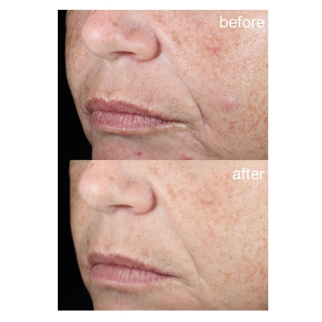 DERMALOGICA RETINOL CLEARING OIL