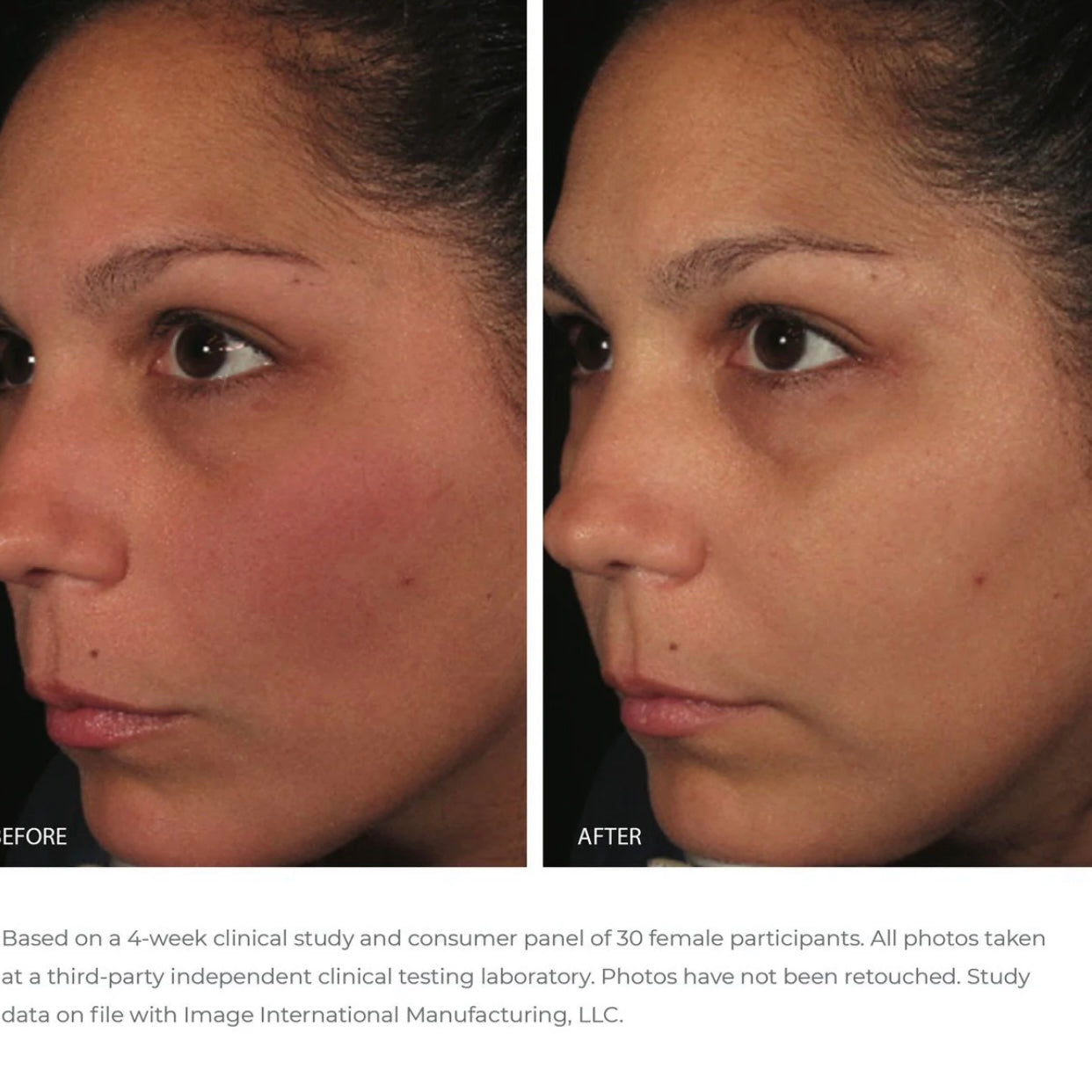 IMAGE ORMEDIC BALANCING ANTIOXIDANT SERUM